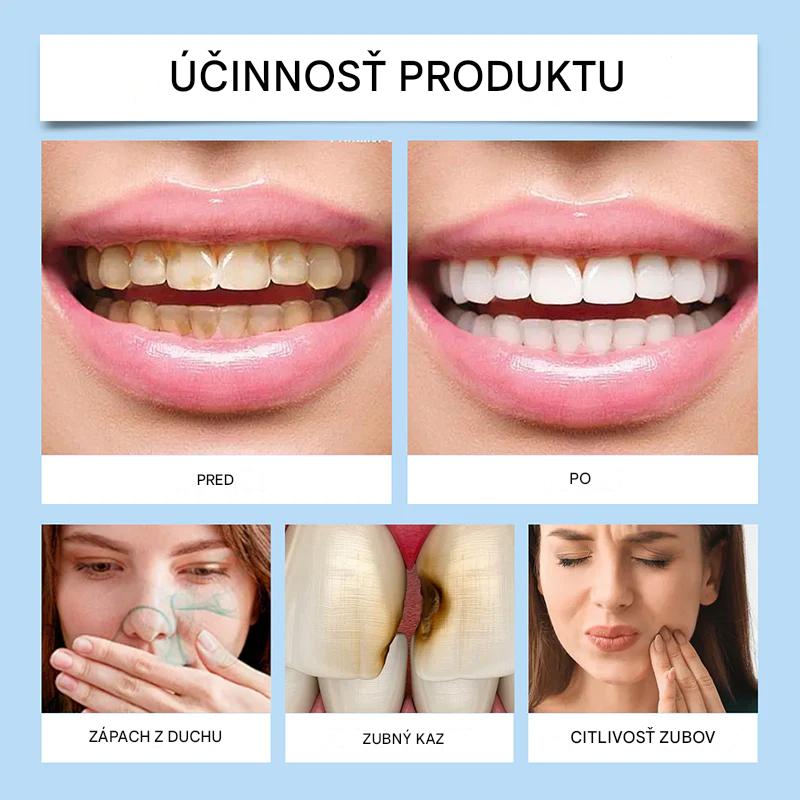 🦷 Limitovaná ponuka【🎁📿Ružový náhrdelník zadarmo🎁】— Sada na dennú starostlivosť o ústnu dutinu (štyri kusy)