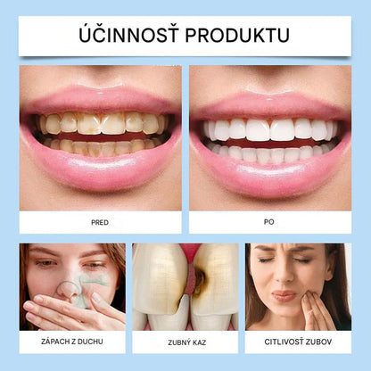 🦷 Limitovaná ponuka【🎁📿Ružový náhrdelník zadarmo🎁】— Sada na dennú starostlivosť o ústnu dutinu (štyri kusy)