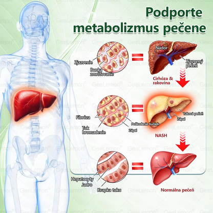 𝐆𝐞𝐞𝐋𝐞𝐦𝐨𝐧® 🎉𝐆𝐥𝐮𝐦𝐚𝐬𝐞𝐭𝐢𝐝𝐚 8 v 1 Náplast s Nano Mikroihličkami na Chudnutie a Zdravie ✅ (Iba raz denne, viditeľné zmeny za 7 dní) Pre obezitu, kardiovaskulárne zdravie, cukrovku, spánkovú apneu, štítnu žľazu, črevné zdravie, kĺbové problémy a ďalšie