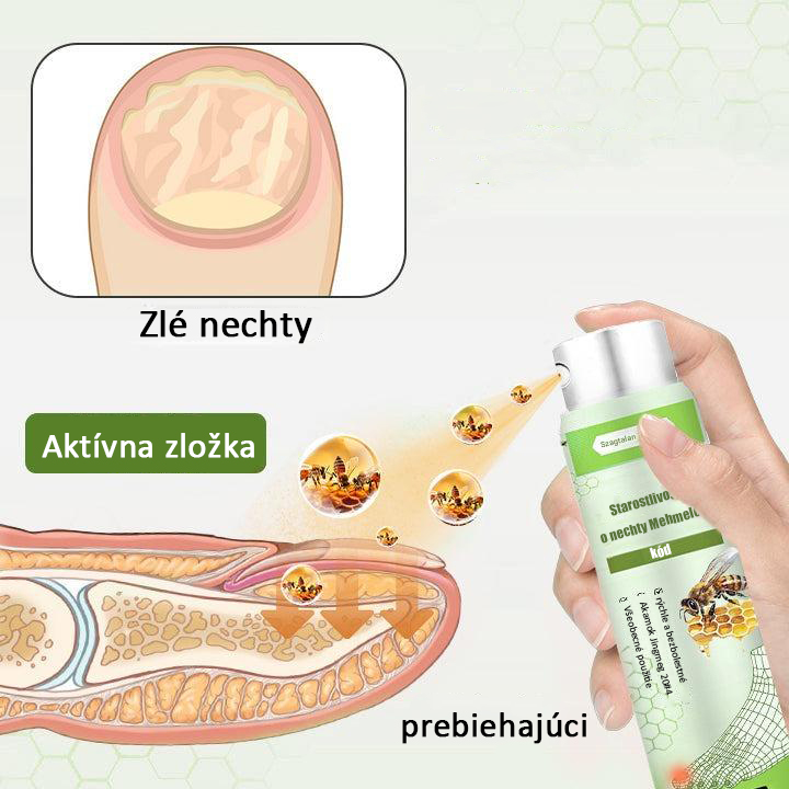 Časovo obmedzená zľava 50 % | Sprej s včelím jedom Foulme® NailRescue🐝