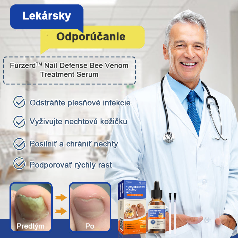🐝🐝FurzeroTM Včelí jed na plesne na nechtoch: kompletné riešenie plesní na nechtoch 🌟👣