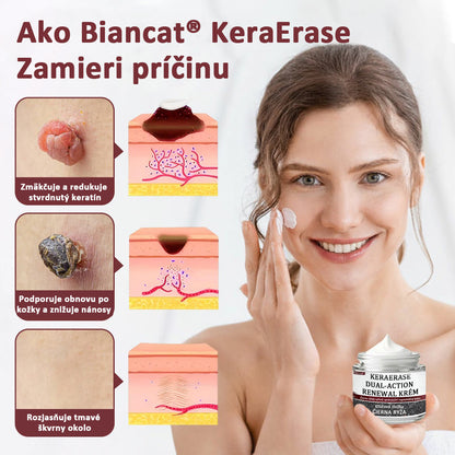 Biancat®KeraErase regeneračný krém s dvojitým účinkom