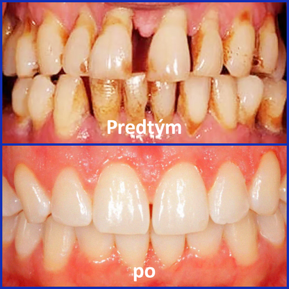 🌟Rolimey® VioCore Zubná pasta s včelím jedom
