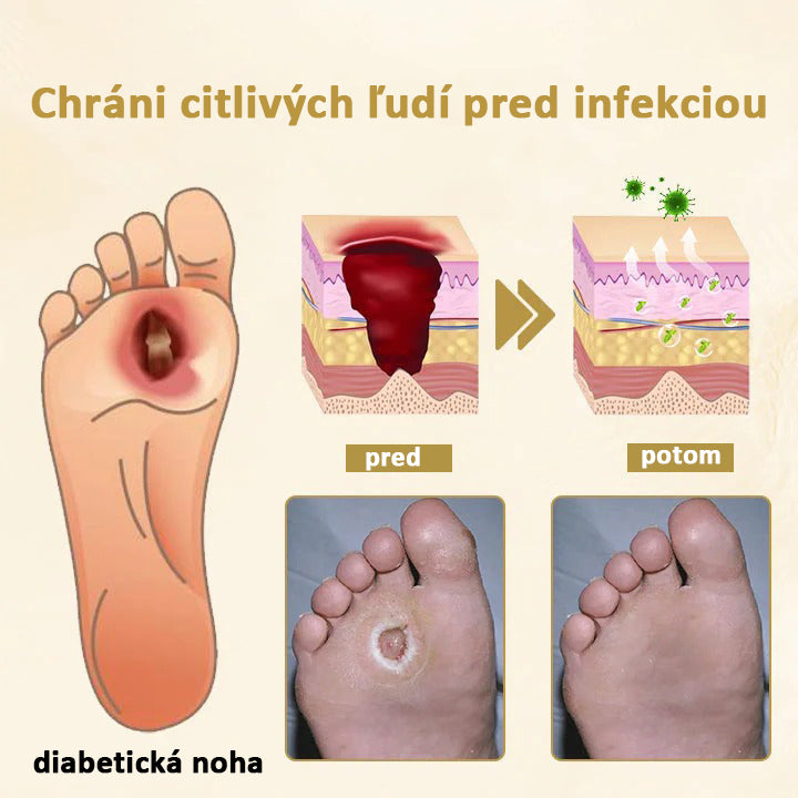 Hojivý sprej s včelím jedom Cvreoz® na hojenie a regeneráciu rán na rukách a nohách🌿