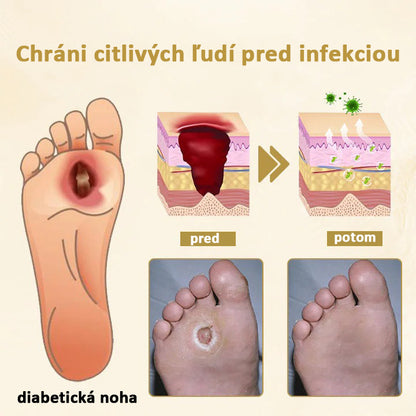 Hojivý sprej s včelím jedom Cvreoz® na hojenie a regeneráciu rán na rukách a nohách🌿