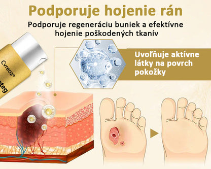 Hojivý sprej s včelím jedom Cvreoz® na hojenie a regeneráciu rán na rukách a nohách🌿