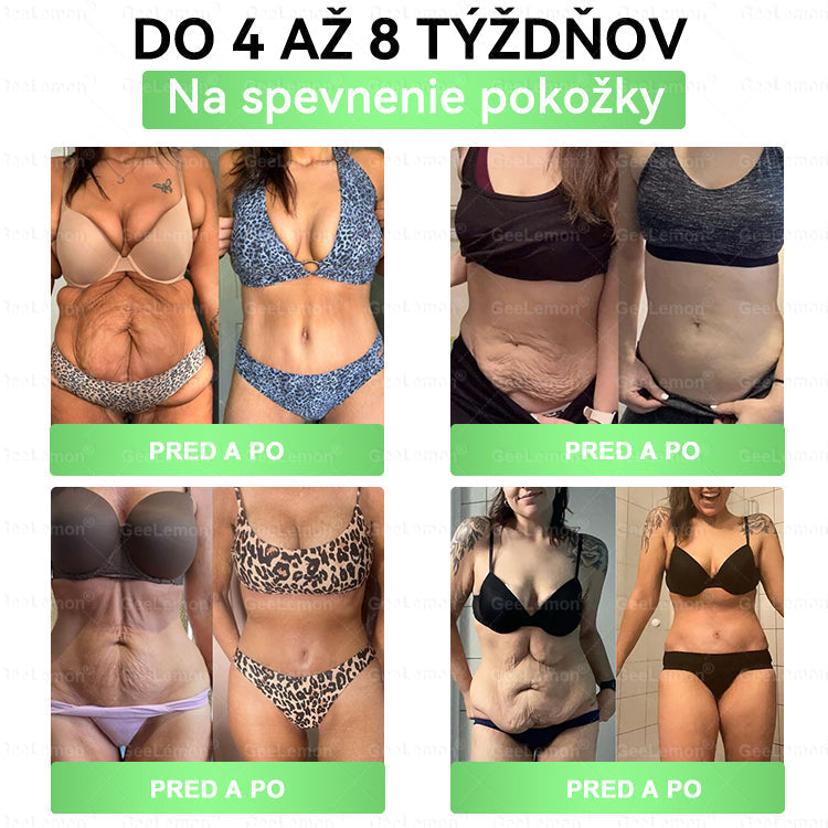 𝐆𝐞𝐞𝐋𝐞𝐦𝐨𝐧® 🎉𝐆𝐥𝐮𝐦𝐚𝐬𝐞𝐭𝐢𝐝𝐚 8 v 1 Náplast s Nano Mikroihličkami na Chudnutie a Zdravie ✅ (Iba raz denne, viditeľné zmeny za 7 dní) Pre obezitu, kardiovaskulárne zdravie, cukrovku, spánkovú apneu, štítnu žľazu, črevné zdravie, kĺbové problémy a ďalšie